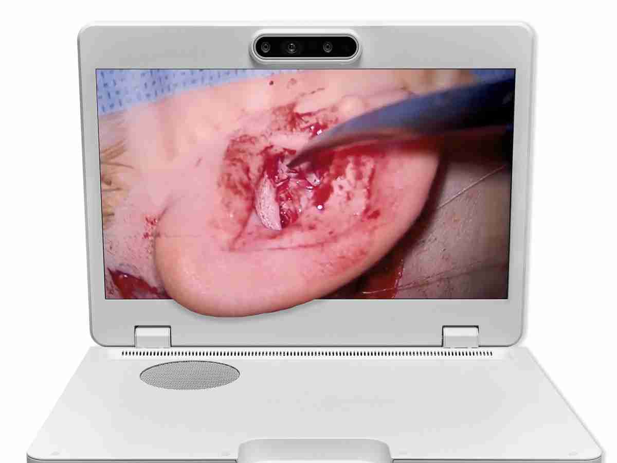 达擎之＂Heads-up 3D显微手术显示系统＂，，整合4K裸眼3D显示及眼球追踪系统，，具备快速追踪人眼移动位置功能，，，减轻医师长时间维持固定姿势的负担，，让医师能有更宽广清晰的3D立体视野及更舒适的姿势来执行手术。。